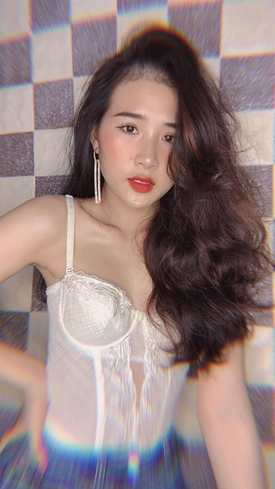 Cô gái bị méo miệng, liệt nửa mặt vì một thói quen ăn uống hàng triệu người trẻ đang có, ngoại hình sau khi can thiệp thẩm mỹ thực sự đáng kinh ngạc-5