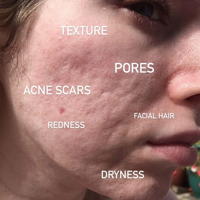 Da bị mất nước: Nếu không làm điều này kịp thời thì da dẻ xuống cấp, già tới cả chục tuổi-1