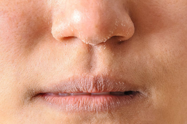 Da bị mất nước: Nếu không làm điều này kịp thời thì da dẻ xuống cấp, già tới cả chục tuổi-2