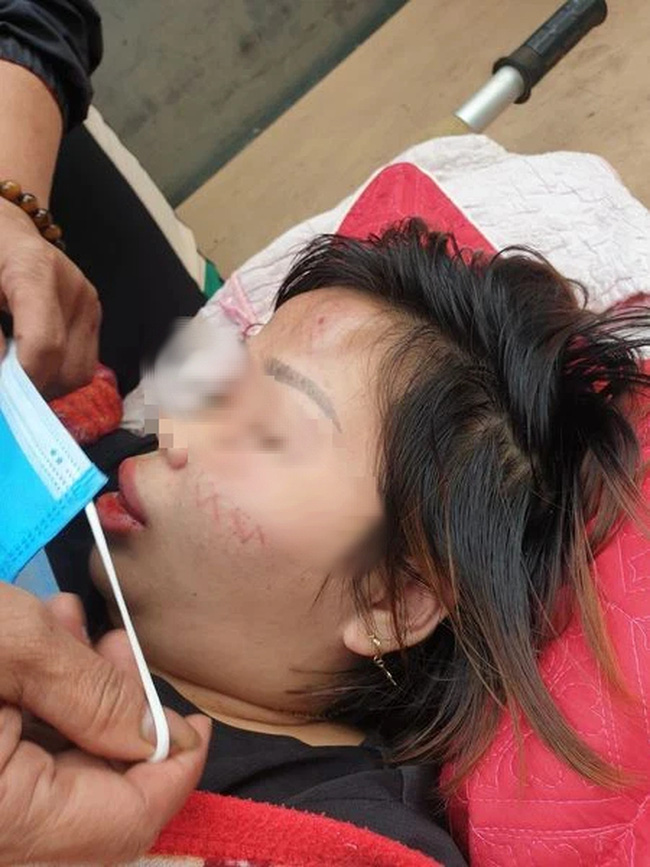 Vụ người phụ nữ bị đối tượng lạ xông vào nhà hành hung dã man: Nạn nhân vẫn bất tỉnh, người nhà cầu cứu-1