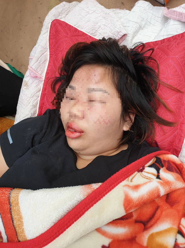 Vụ người phụ nữ bị đối tượng lạ xông vào nhà hành hung dã man: Nạn nhân vẫn bất tỉnh, người nhà cầu cứu-2