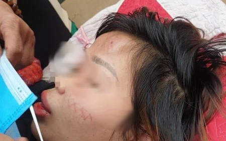 Lộ nguyên nhân gã đàn ông đánh dã man nữ chủ quán hải sản đến bất tỉnh ở Hà Nội-2