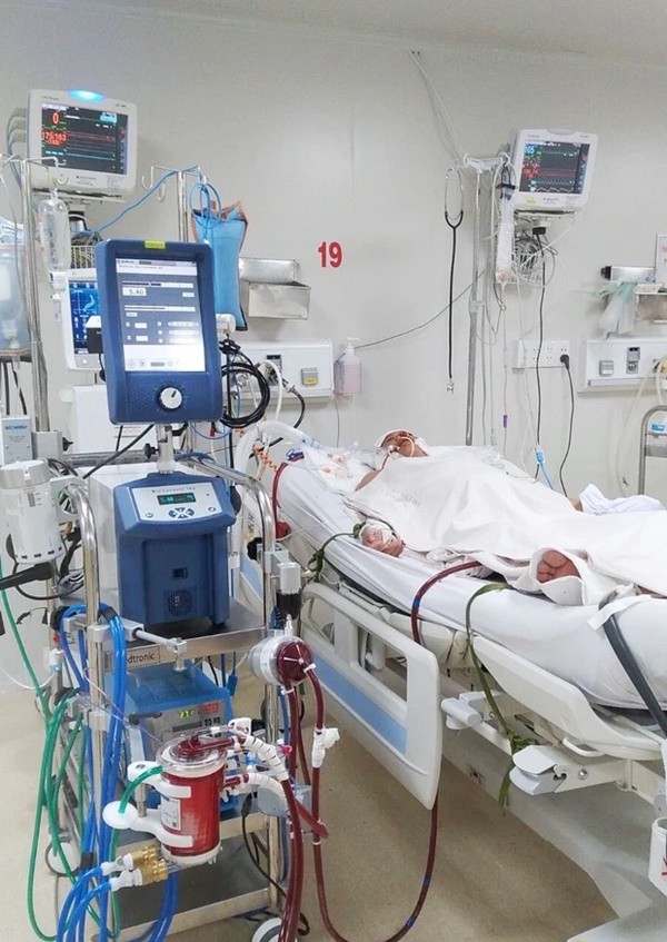 Sau nhiều năm cố gắng mới có bầu, sản phụ mang song thai nhiễm Covid-19 nặng, phải can thiệp ECMO và cuộc hồi sinh từ cửa tử-1