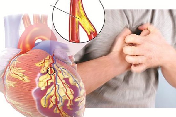 Thói quen xấu tàn phá tim mạch, nhất là khi trời lạnh, nếu còn duy trì cần từ bỏ ngay-1