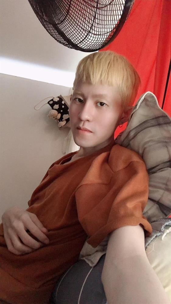 Nam ca sĩ bị viêm gan, suy dinh dưỡng nặng: Bác sĩ bảo trả về, tình trạng có thể không cứu được-2