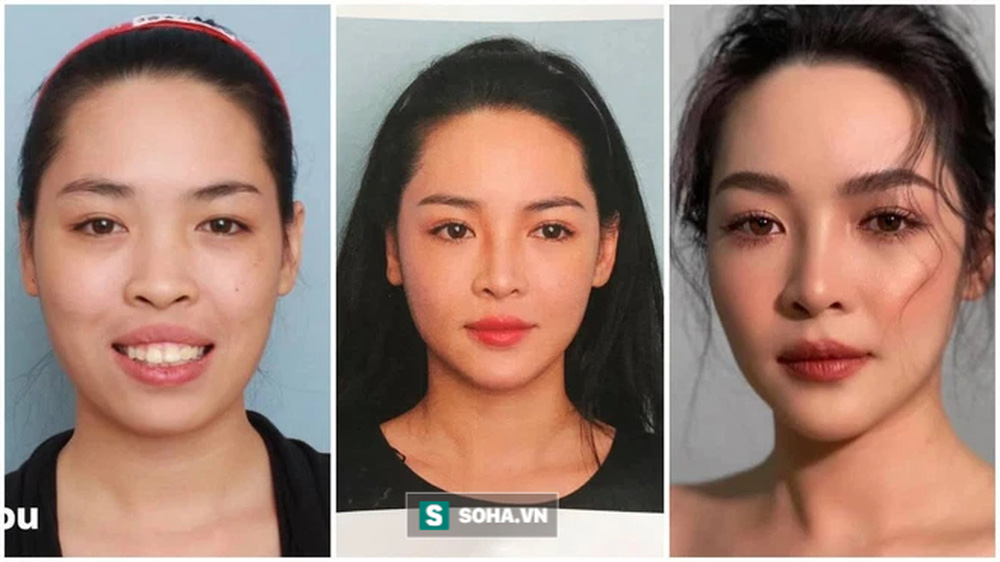 Hot girl phẫu thuật thẩm mỹ Vũ Thanh Quỳnh sau 7 năm lột xác: Lộng lẫy hơn, giàu có thêm-1