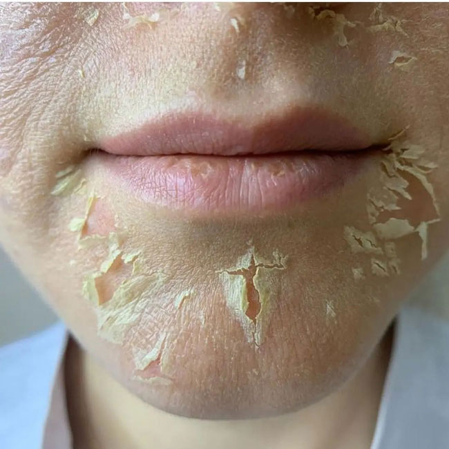 4 bước dưỡng da mà 90% chị em mắc sai lầm, bảo sao da dẻ cứ khô khốc-1