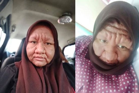 Cô gái 28 tuổi xinh đẹp biến thành bà lão già nua đen nhẻm, nguyên nhân phía sau khiến hội chị em đã có chồng 