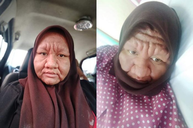 Cô gái 28 tuổi xinh đẹp biến thành bà lão già nua đen nhẻm, nguyên nhân phía sau khiến hội chị em đã có chồng tái mặt-1