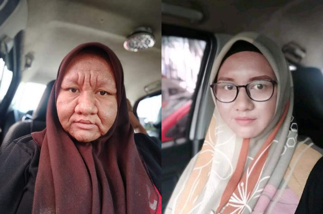 Cô gái 28 tuổi xinh đẹp biến thành bà lão già nua đen nhẻm, nguyên nhân phía sau khiến hội chị em đã có chồng tái mặt-2