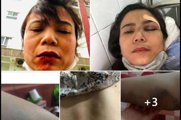 Bị đánh lên bờ xuống ruộng, người phụ nữ không chịu ly hôn vì chồng quá đẹp trai, câu chuyện đằng sau khiến dân tình quay xe gấp-6