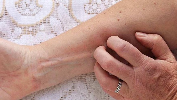 Đêm nào cũng tỉnh giấc vì 3 lý do kỳ lạ này, coi chừng đường huyết tăng cao quá mức, chủ quan có thể gây biến chứng nguy hiểm cho tim, thận-2