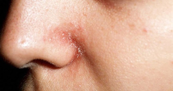 Mũi là đèn tín hiệu của phổi: nếu mũi xuất hiện 3 dấu hiệu lạ thì bạn nên đi kiểm tra phổi ngay-2