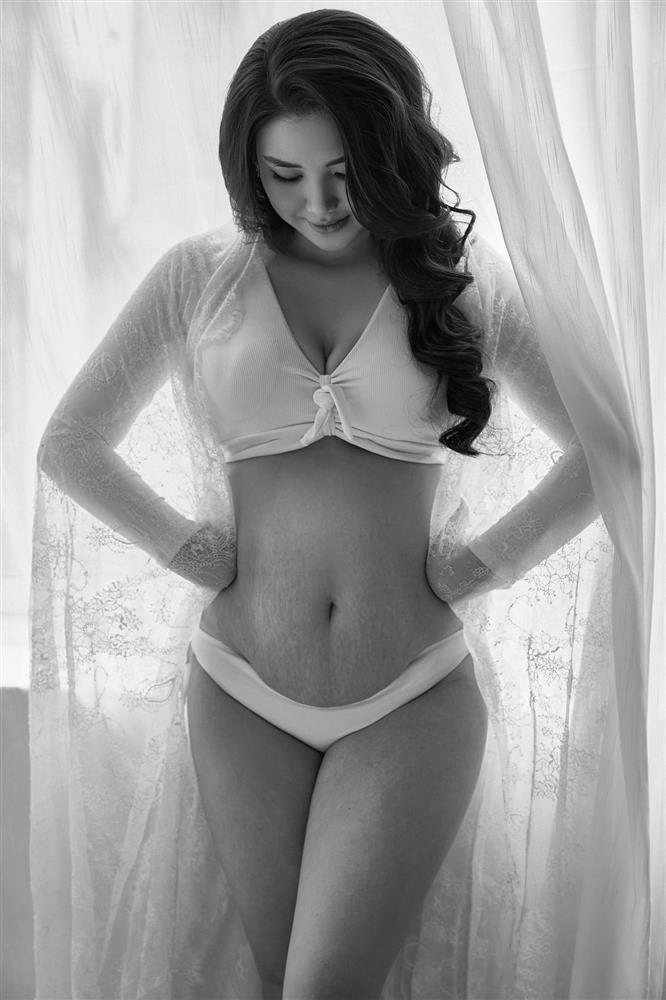 Mỗi lần chồng vén bụng lên là cảm giác nhói buốt, cơ thể mình chảy xệ, nhăn nheo, rạn nứt hết rồi-5