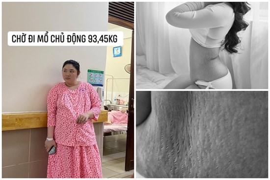 ''Mỗi lần chồng vén bụng lên là cảm giác nhói buốt, cơ thể mình chảy xệ, nhăn nheo, rạn nứt hết rồi''