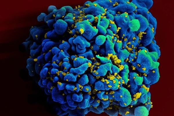Phát hiện người thứ hai tự khỏi HIV-1