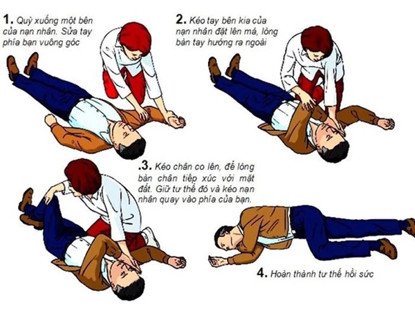 Việc cần làm ngay khi gặp bệnh nhân đột quỵ-1