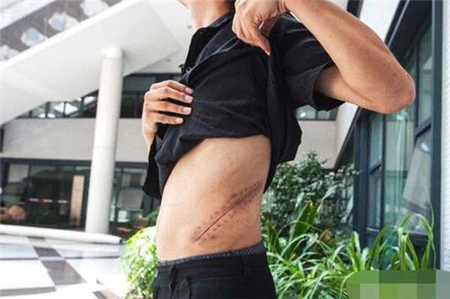 Nam sinh bán thận mua iPhone năm ấy: Giờ cuộc sống bi đát đến rùng mình, giá như được bố mẹ bảo ban kỹ hơn thì đời đã khác!-2