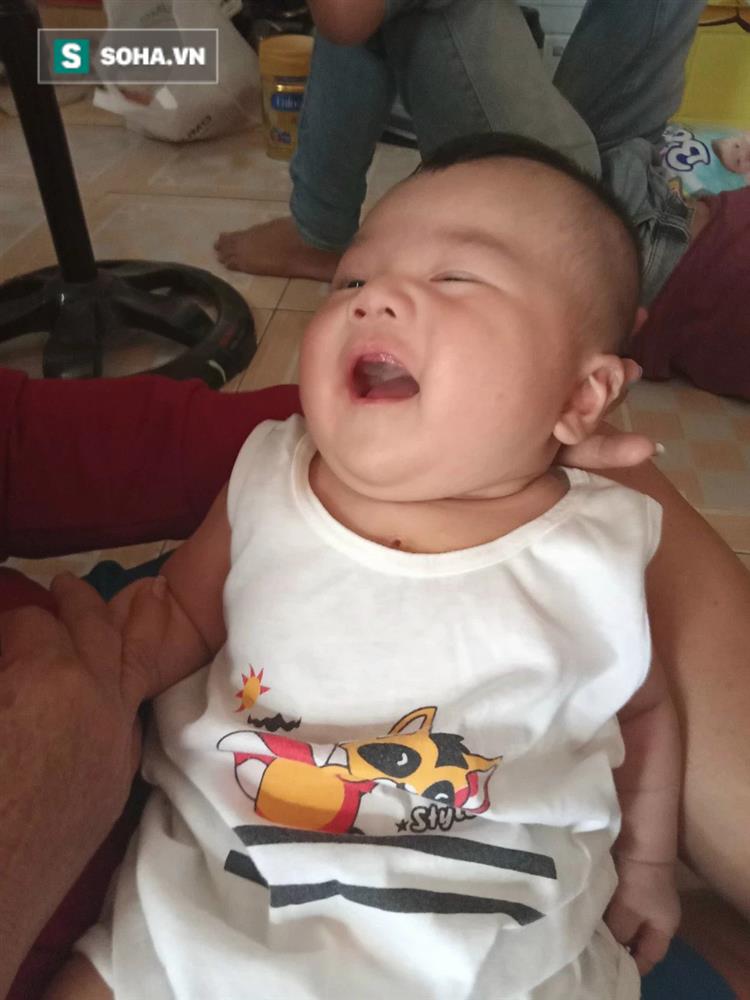 Em bé vừa mổ tim bẩm sinh đã dính Covid-19: 11 tháng 2 lần đối diện tử thần-3