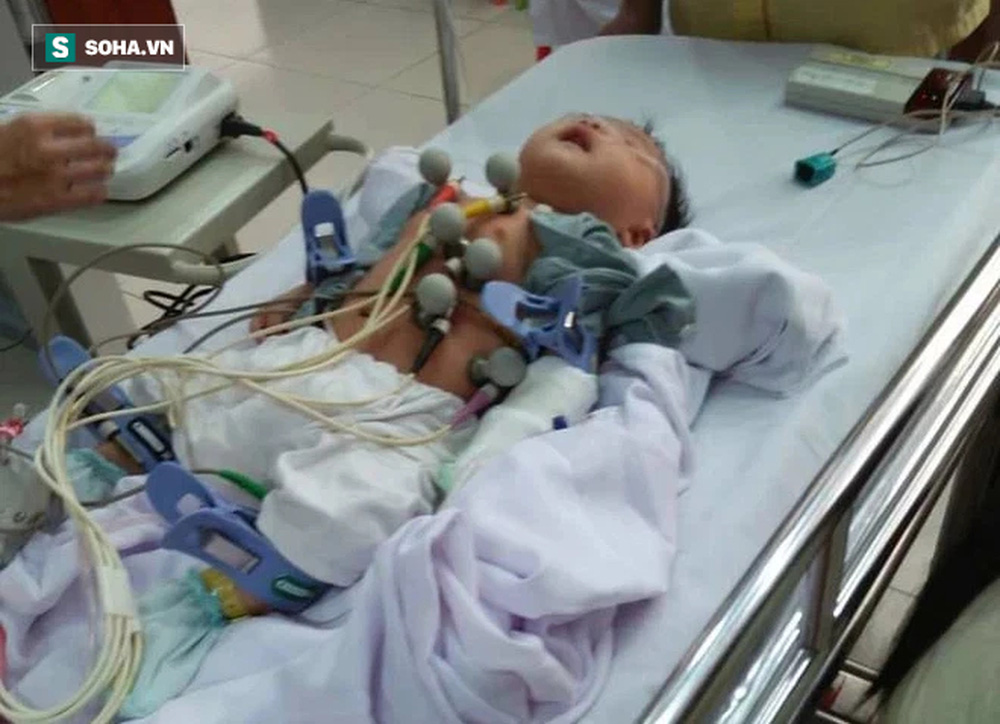 Em bé vừa mổ tim bẩm sinh đã dính Covid-19: 11 tháng 2 lần đối diện tử thần-5