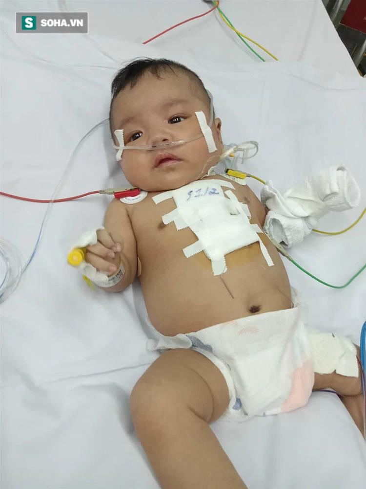 Em bé vừa mổ tim bẩm sinh đã dính Covid-19: 11 tháng 2 lần đối diện tử thần-6