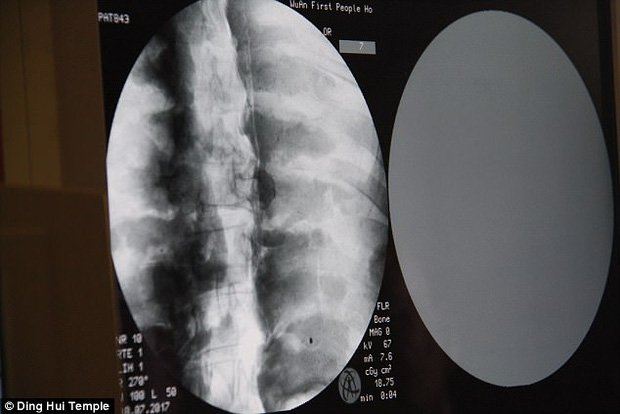 Tưởng bức tượng mạ vàng tinh xảo hóa ra xác ướp nhà sư 1.000 năm tuổi, kết quả chụp CT khiến cả thế giới sốc nặng-9