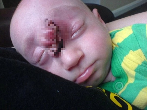 Bé trai sinh ra với bộ não bên ngoài hộp sọ, bác sĩ lắc đầu cho biết chỉ sống được 1 giờ, hình ảnh 13 năm sau khiến giới y học phải kinh ngạc-3