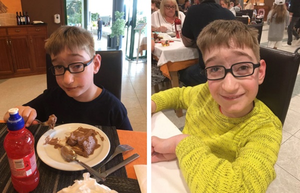 Bé trai sinh ra với bộ não bên ngoài hộp sọ, bác sĩ lắc đầu cho biết chỉ sống được 1 giờ, hình ảnh 13 năm sau khiến giới y học phải kinh ngạc-4