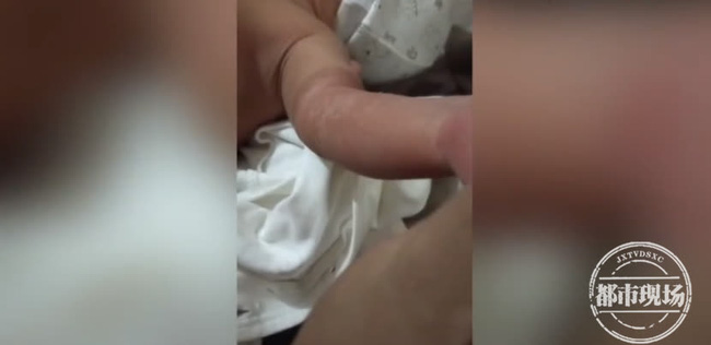 Cánh tay của trẻ 1 ngày tuổi bỗng nhiên bầm đen, khi đưa đến bệnh viện mới biết do sự cẩn thận quá mức của người mẹ-3