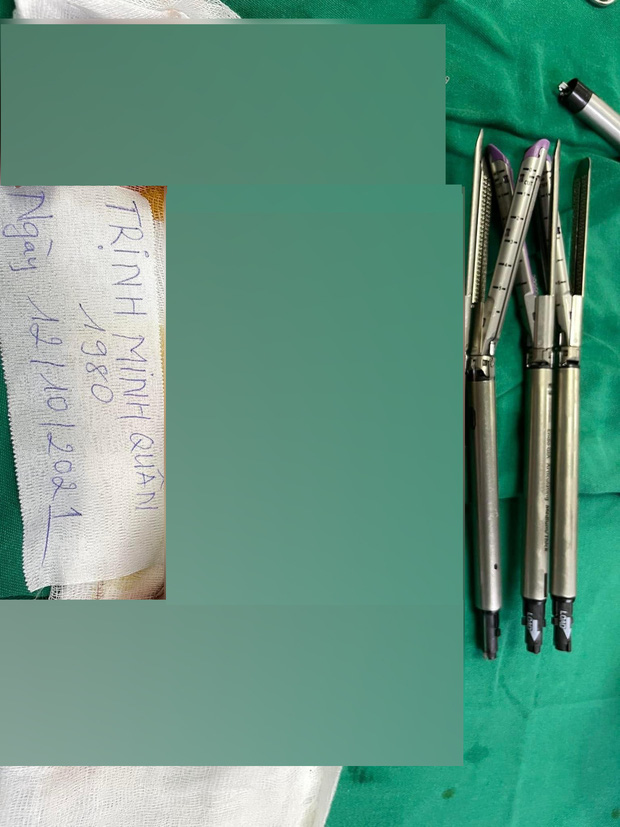 Minh Quân gây sốc khi đăng cận cảnh dạ dày bị cắt bỏ tới 80%, tiết lộ sụt hơn 10kg sau 40 ngày phẫu thuật-3