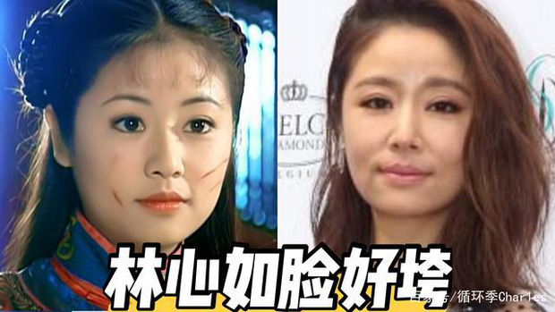 Lâm Tâm Như đang mắc phải 1 căn bệnh khiến gương mặt trở nên lão hoá nhanh chóng ở tuổi 45?-1