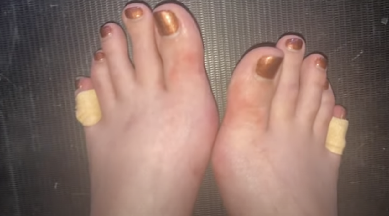 Nữ MC gây sốc khi dẫn chương trình 48 tiếng liên tục không cầm kịch bản, hình ảnh ngón chân tứa máu ai thấy cũng xót-4