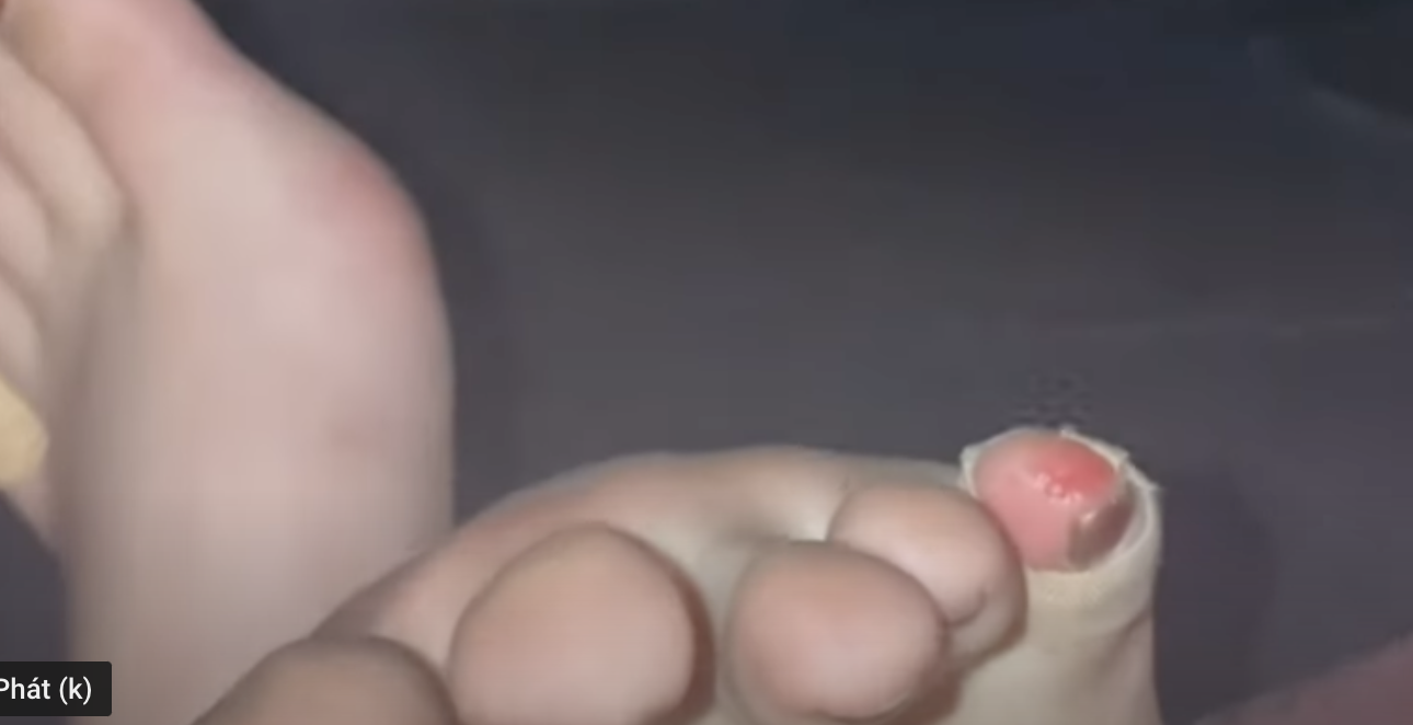 Nữ MC gây sốc khi dẫn chương trình 48 tiếng liên tục không cầm kịch bản, hình ảnh ngón chân tứa máu ai thấy cũng xót-5