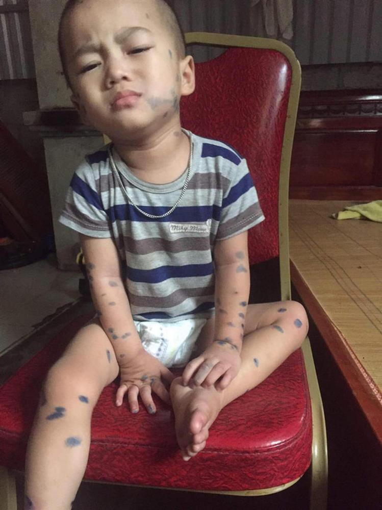 Bố bé 2 tuổi mắc 2 bệnh ung thư, bập bẹ nói con chết: Bằng mọi giá sẽ cứu con tới cùng-3