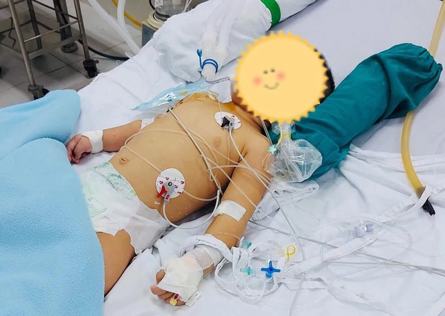 Ngã vào xô nước, bé trai 14 tháng tuổi nguy kịch, BS cảnh báo sai lầm cần tránh khi sơ cứu bệnh nhân đuối nước-1