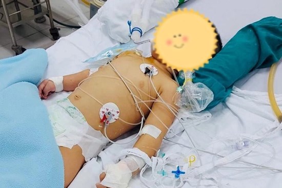 Ngã vào xô nước, bé trai 14 tháng tuổi nguy kịch, BS cảnh báo sai lầm cần tránh khi sơ cứu bệnh nhân đuối nước