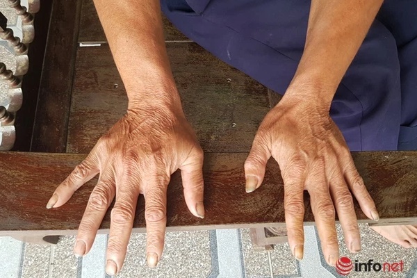 Nghịch tử ngồi tù vì đánh cha đẻ thương tích nặng, người mẹ quặn lòng khi bị hại, bị cáo là chồng, con ruột-2