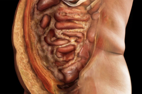 Thực phẩm số 1 giúp đánh bay mỡ nội tạng, mùa đông khỏi lo béo bụng-1