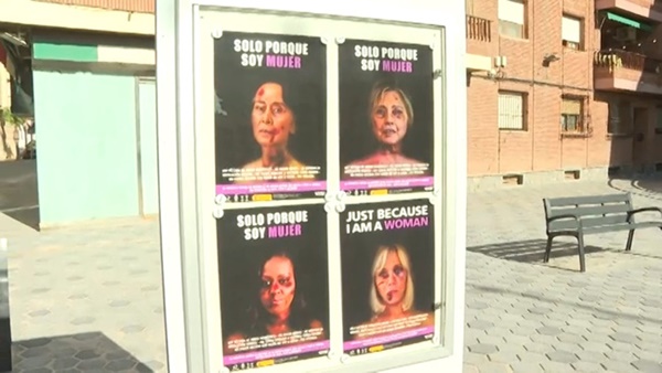 HOT: Công nương Kate lộ gương mặt thâm đen, tím bầm, hoàng gia Anh đưa ra phản hồi khiến dư luận phẫn nộ với tác giả-2