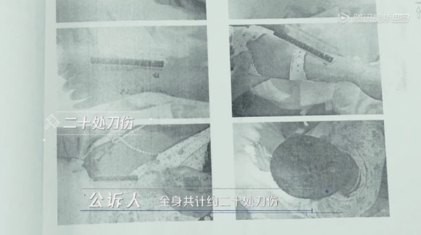 Quỳ gối van xin khi bị lộ gia thế ảo khiến hôn nhân trên bờ vực tan vỡ, gã chồng lươn lẹo lạnh lùng níu kéo vợ bằng 20 nhát dao-2