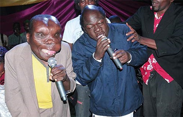 Người đàn ông xấu nhất thế giới” sinh ra đã bị kỳ thị, mấy chục năm sau gây ngỡ ngàng với cuộc đời đáng ghen tỵ-3