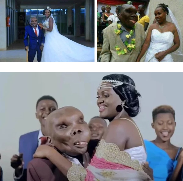 Người đàn ông xấu nhất thế giới” sinh ra đã bị kỳ thị, mấy chục năm sau gây ngỡ ngàng với cuộc đời đáng ghen tỵ-4