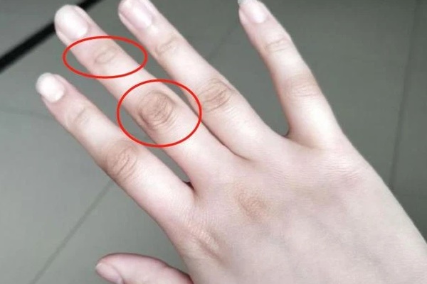3 đặc điểm ở ngón tay giữa giúp bạn nhận biết gan đang có vấn đề-1
