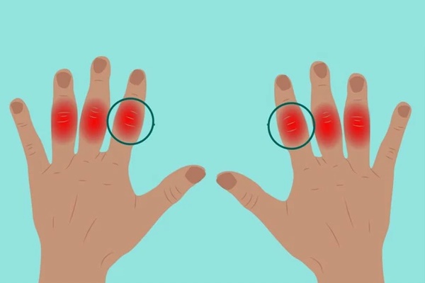 3 đặc điểm ở ngón tay giữa giúp bạn nhận biết gan đang có vấn đề-2