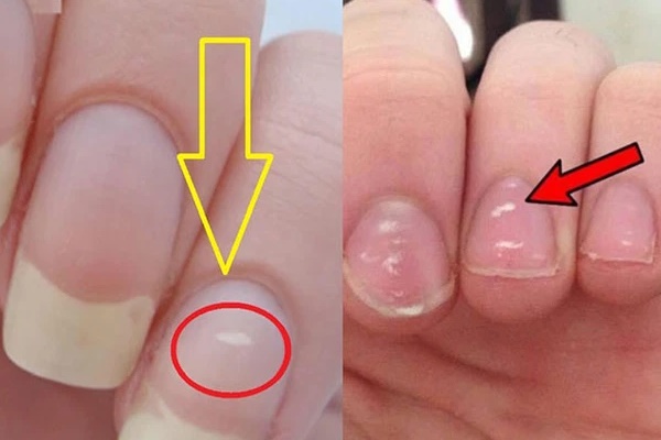 3 đặc điểm ở ngón tay giữa giúp bạn nhận biết gan đang có vấn đề-3