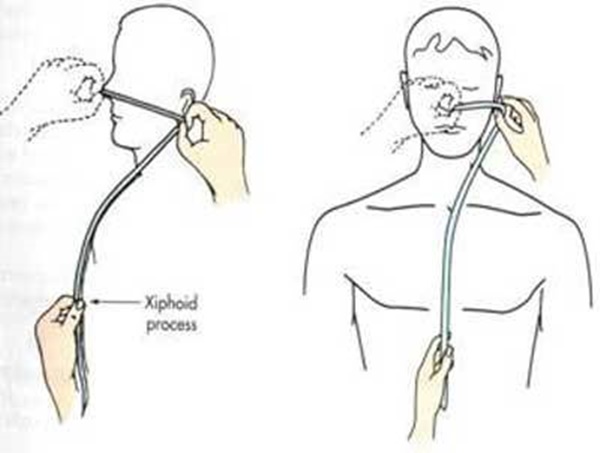 Chế độ dinh dưỡng cho F0 không triệu chứng, F0 kèm bệnh lý nền, F0 nặng-7