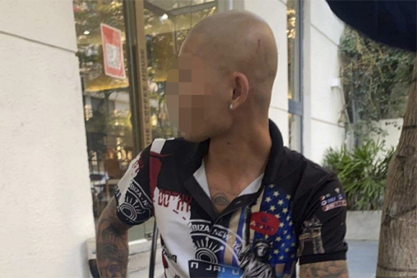 Kinh hoàng: Nam công nhân bị cuốn người vào máy khi đang làm việc trong xưởng, hình ảnh hiện trường gây ám ảnh-3