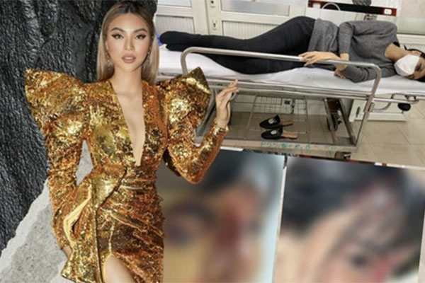 Siêu mẫu Khả Trang mất tích 1 năm, bị đánh dã man là ai?-12