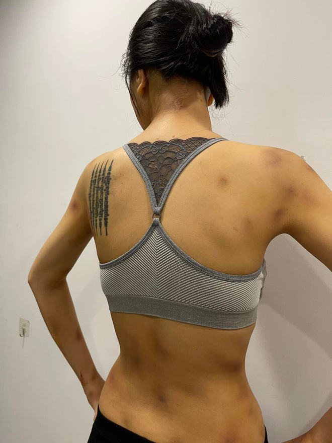 Nữ siêu mẫu Vbiz tung ảnh thương tích đầy mình, bị giam trong nhà đánh đập suốt 1 năm, cắt cả tóc, dí đầu vào bồn cầu-9