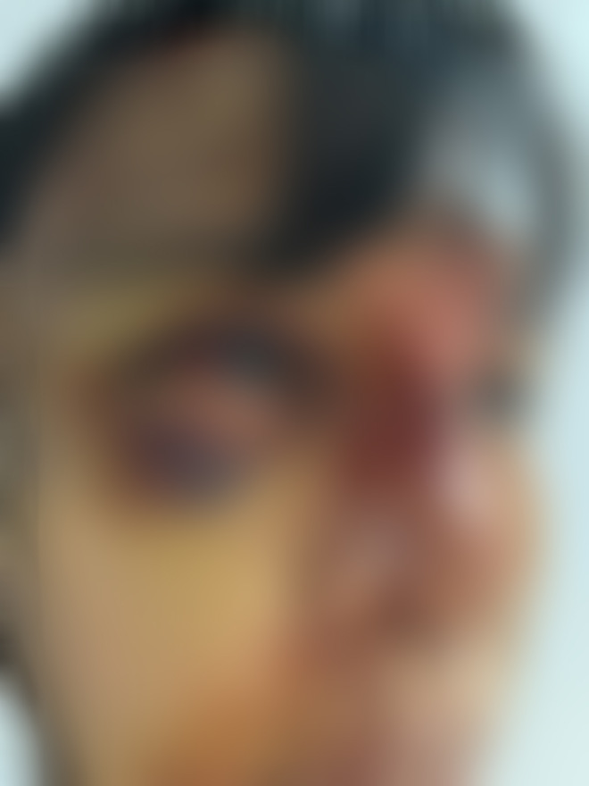 Nữ siêu mẫu Vbiz tung ảnh thương tích đầy mình, bị giam trong nhà đánh đập suốt 1 năm, cắt cả tóc, dí đầu vào bồn cầu-3